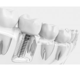 Лечебные материалы