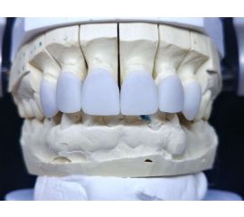 Зуботехническая лаборатория